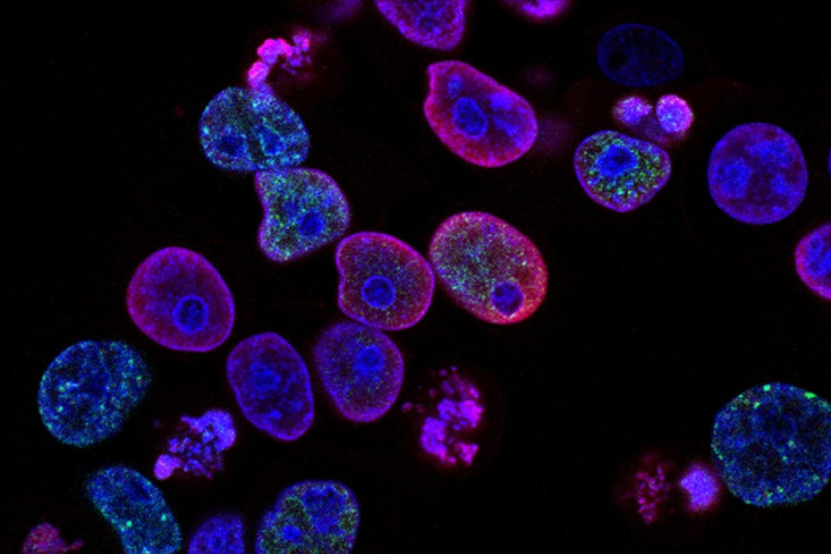 Révolution : une pilule quotidienne double les chances de survie pour le cancer le plus mortel
